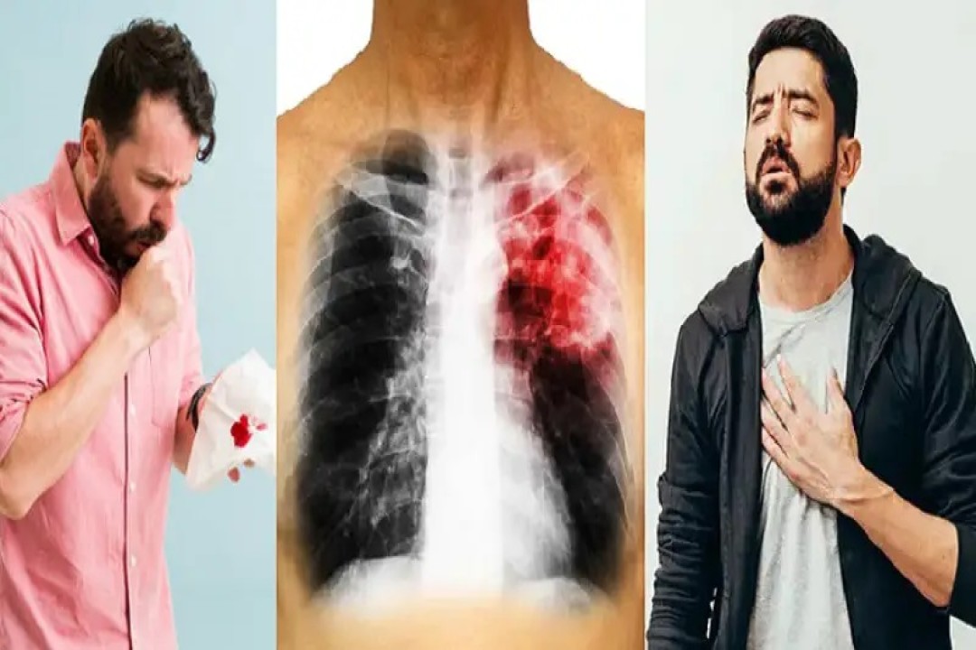 শুধু একটা পাতা! ফুসফুসে জমে থাকা বিষ এক সপ্তাহেই ধুয়ে দেবে!